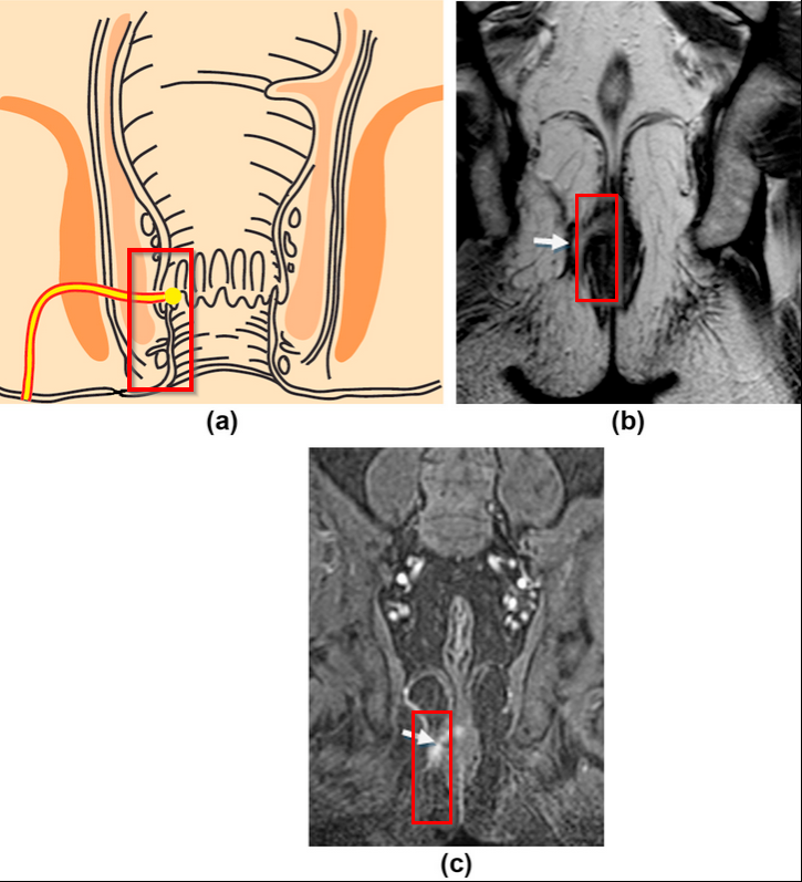Как измерять B